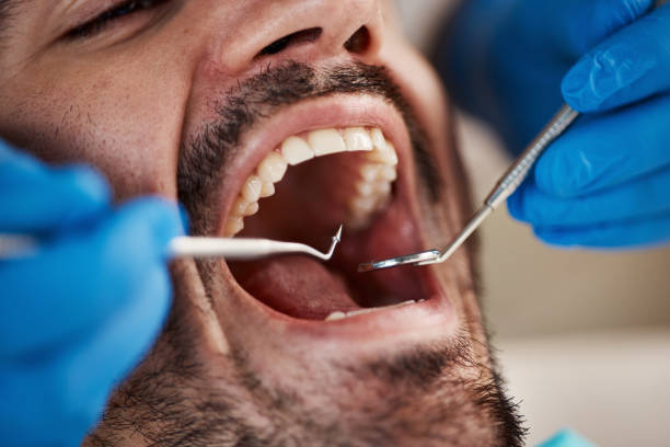 Best Emergency Gum Pain Relief  in Homer City, PA